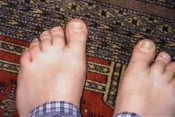 Toes on a Persian carpet