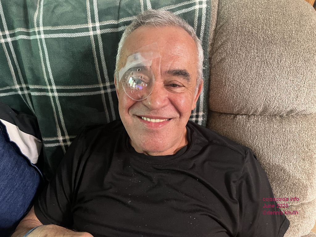 Cateract eye surgery recovery
